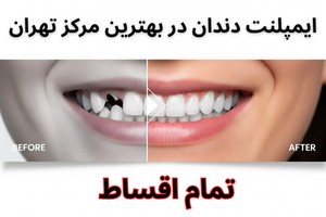 عکس خفن 50 عکس پروفایل شیک