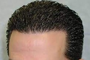 یه روزه مو بکار؛ قسطی پرداخت کن (فقط تا پایان امروز)