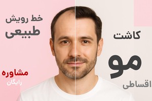 تخمین هزینه کاشت با ثبت فرم👇
